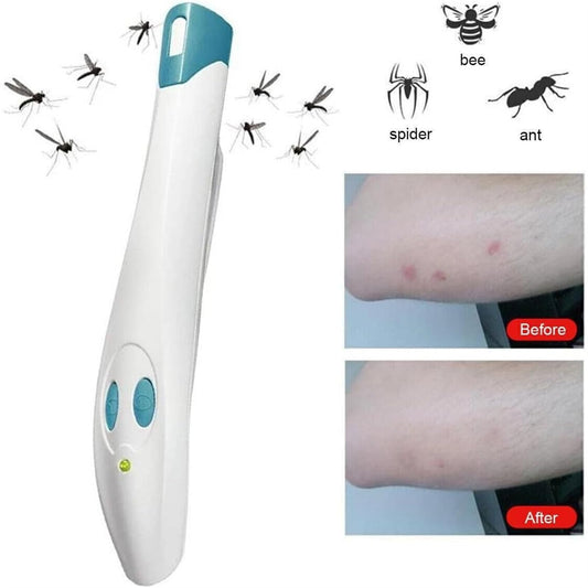 Portable Anti-Itch Pen - Electronic Relief Device for Mosquito and Insect Bites