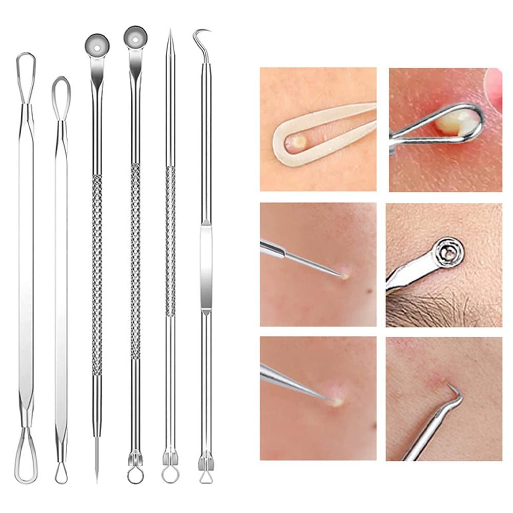 15Pcs Stainless Steel Blackhead Remover Pimple Popper Tools Kit with Metal Case - Direct On Sale