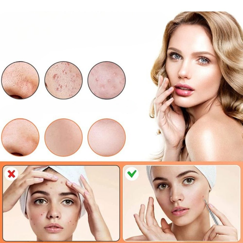 15Pcs Stainless Steel Blackhead Remover Pimple Popper Tools Kit with Metal Case - Direct On Sale