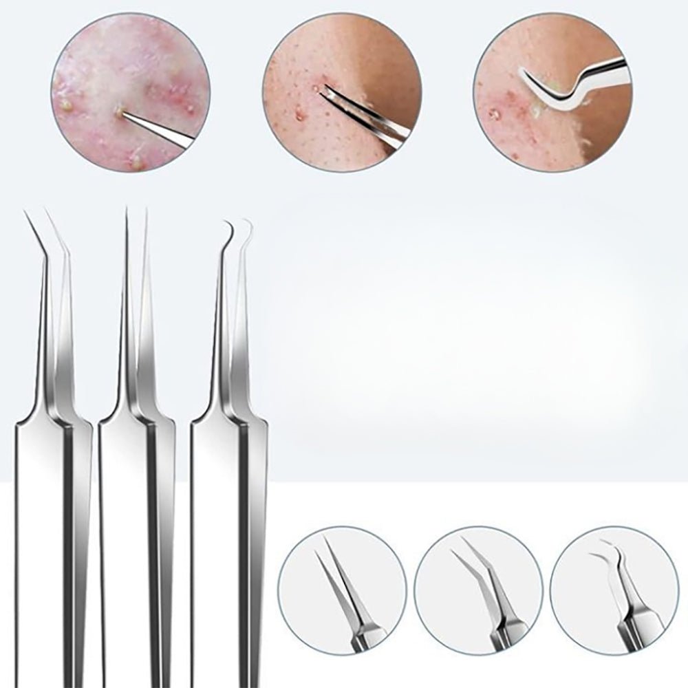 15Pcs Stainless Steel Blackhead Remover Pimple Popper Tools Kit with Metal Case - Direct On Sale