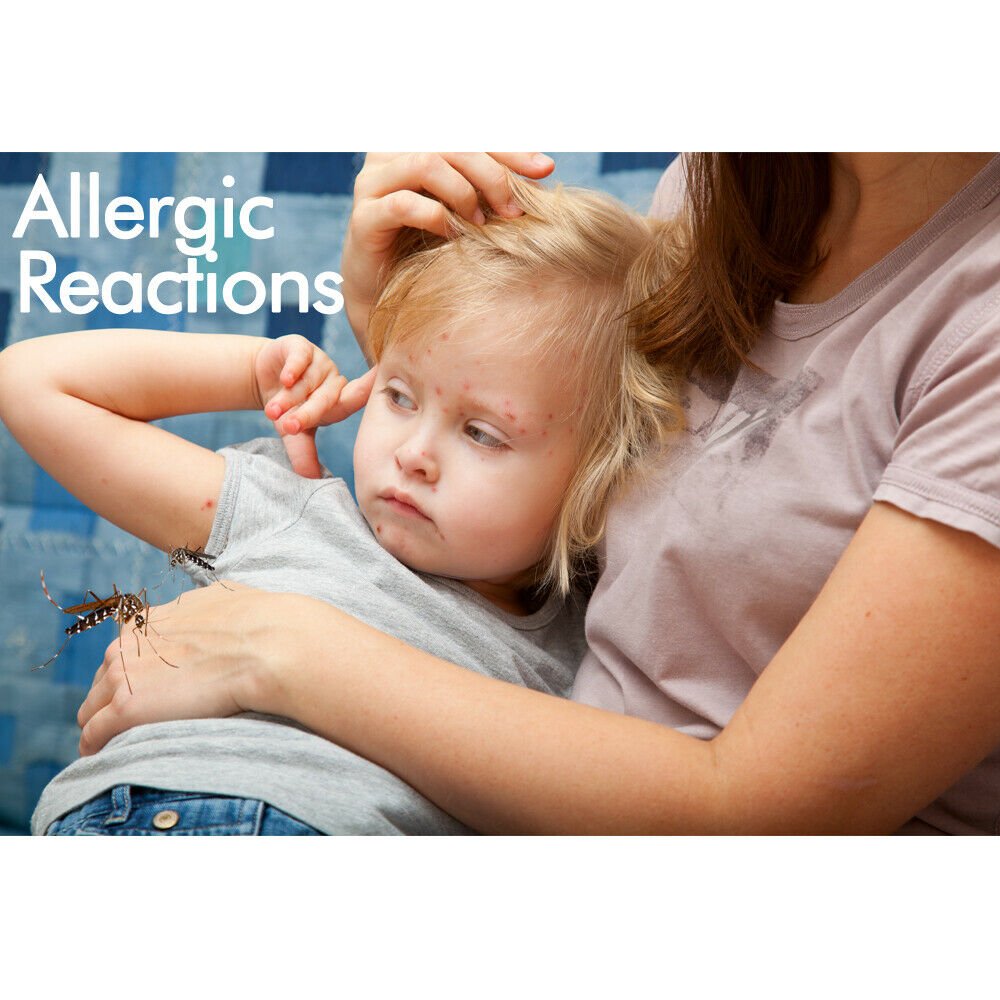 Mosquito Killer Pest Fly Bug Zapper Catcher Trap Electric UV - A Aluminium - Direct On Sale